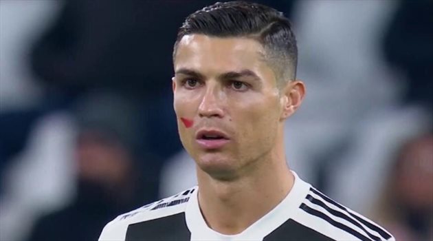 كريستيانو رونالدو يشارك بديلا للمرة الأولى مع يوفنتوس بالدوري الإيطالي