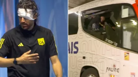 إلغاء لقاء مارسيليا وليون في الدوري الفرنسي بسبب دماء لبطل العالم