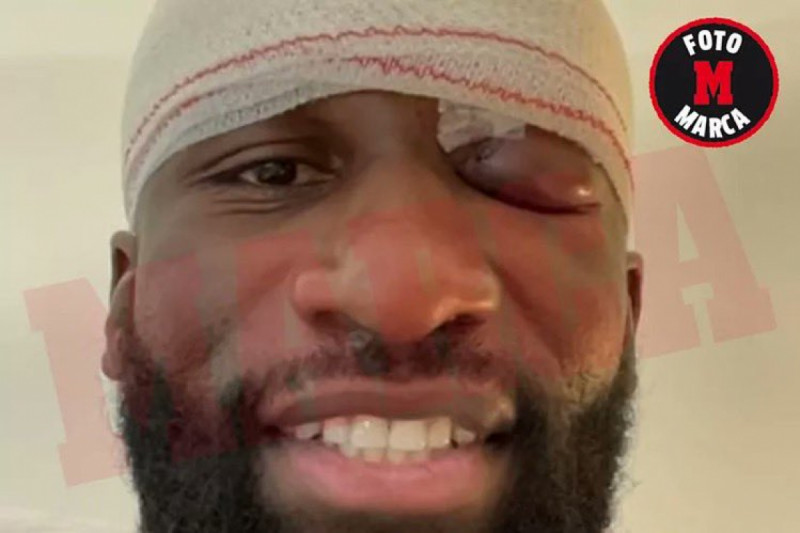 روديجر روديجر