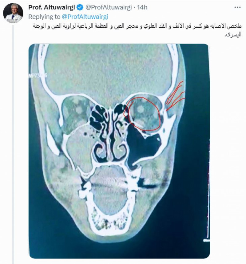 ياسر الشهراني