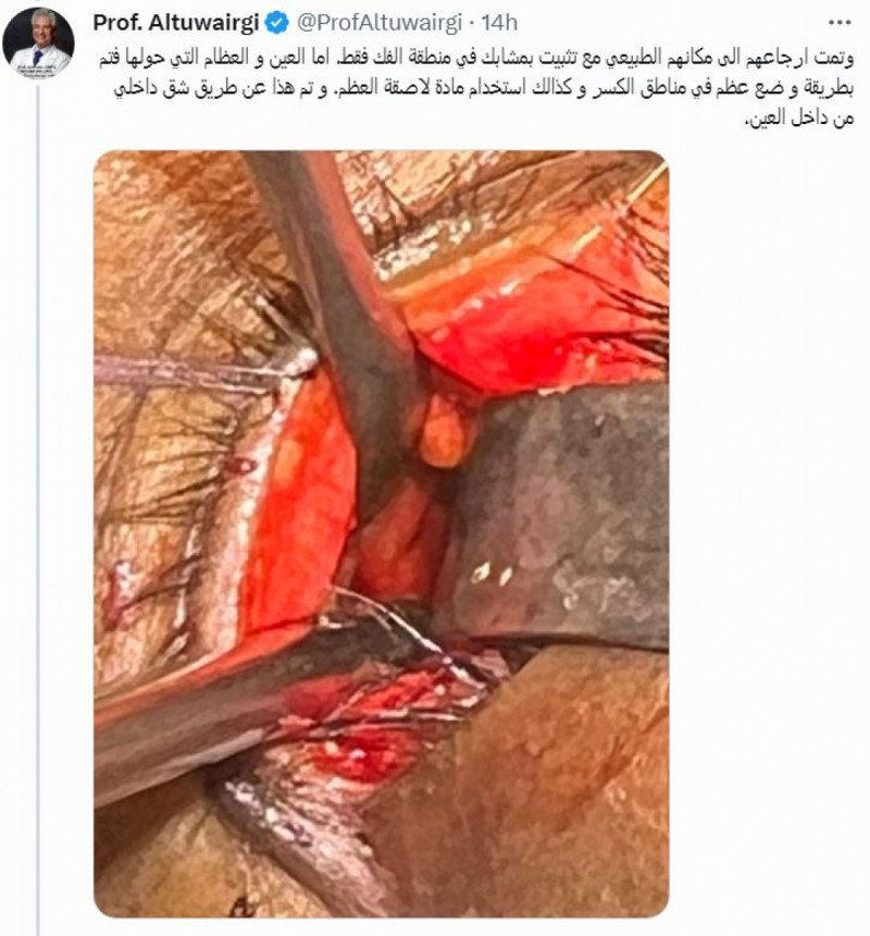 ياسر الشهراني